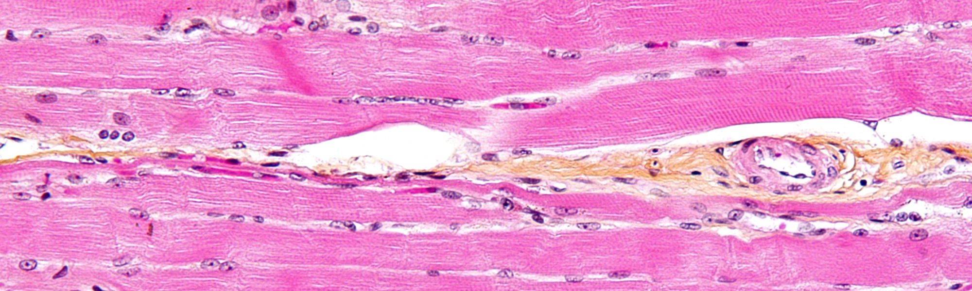 Muscle tissue banner